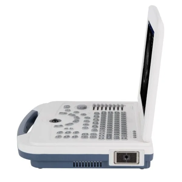 Portable Ultrasound Machine 580 — изображение 2